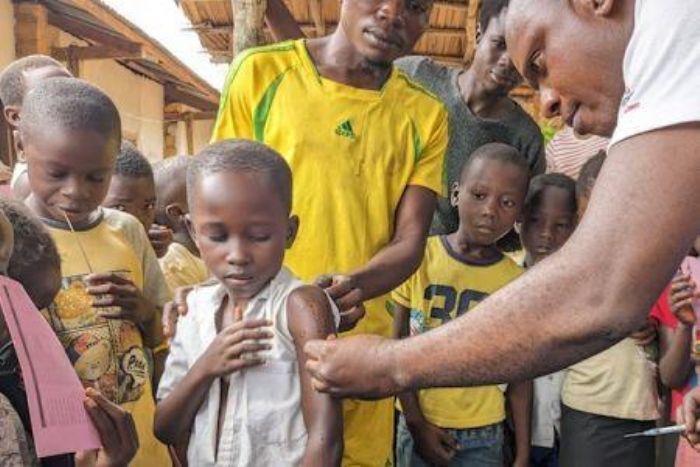 La RDC et l’Ouganda en proie à la rougeole : le point santé hebdomadaire